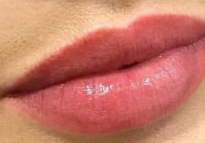 Spa labial